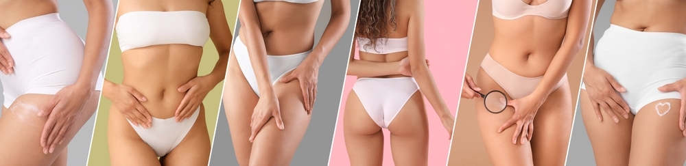 Stretch Mark Cream